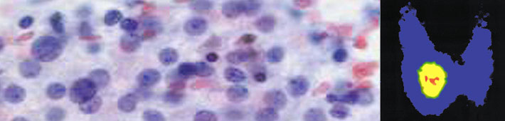 Szintigrafie Schilddr&uuml;se